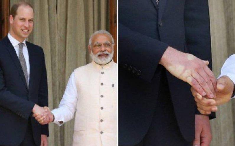 The hand of the average man after shaking hands with Narendra Modi and after shaking hands with Trump