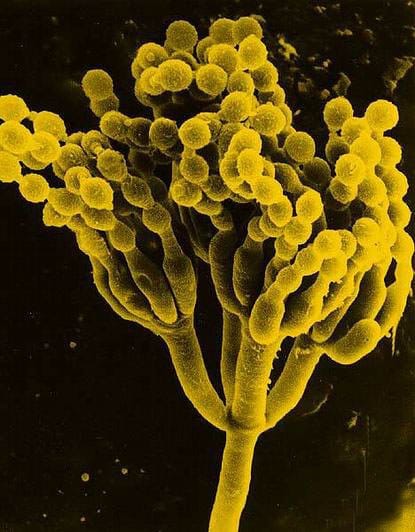 The name penicillin comes from Latin penicillus, brush, and is related to the word penis