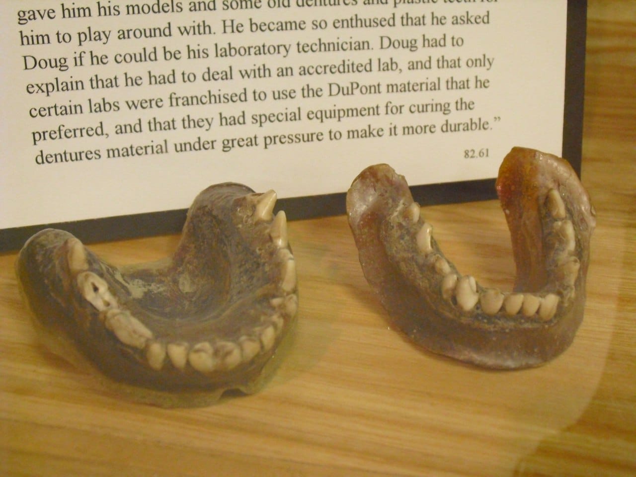 An American in the early 20th century made himself jaws with coyote teeth from toothbrushes