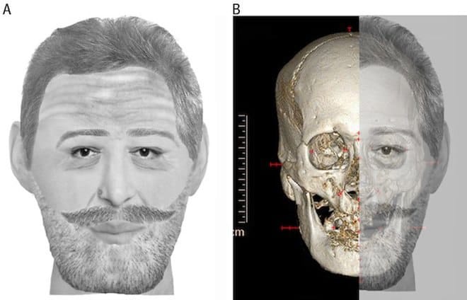 À gauche, la reconstitution du visage d'un homme moustachu et barbu ; à droite, un scanner 3D d'un crâne superposé à la moitié de ce visage.
