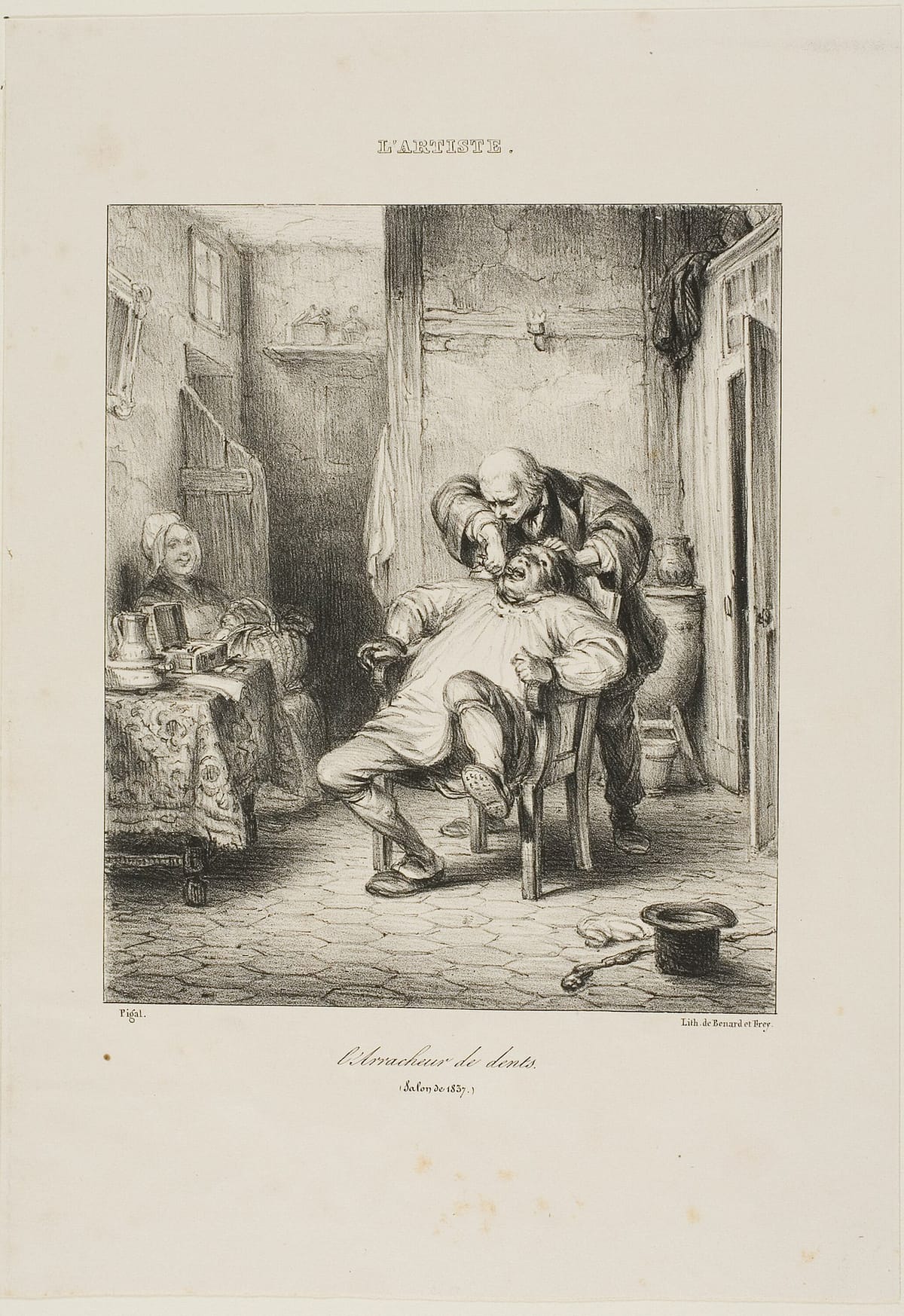 Зубодёр, Франция, 1837