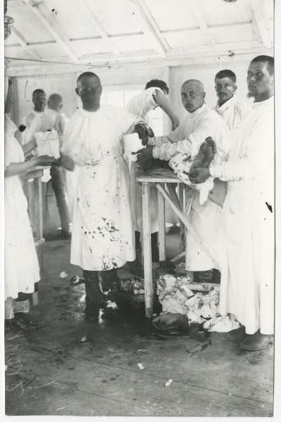 Ампутация ноги, Духовщинский полк, 1915-1917