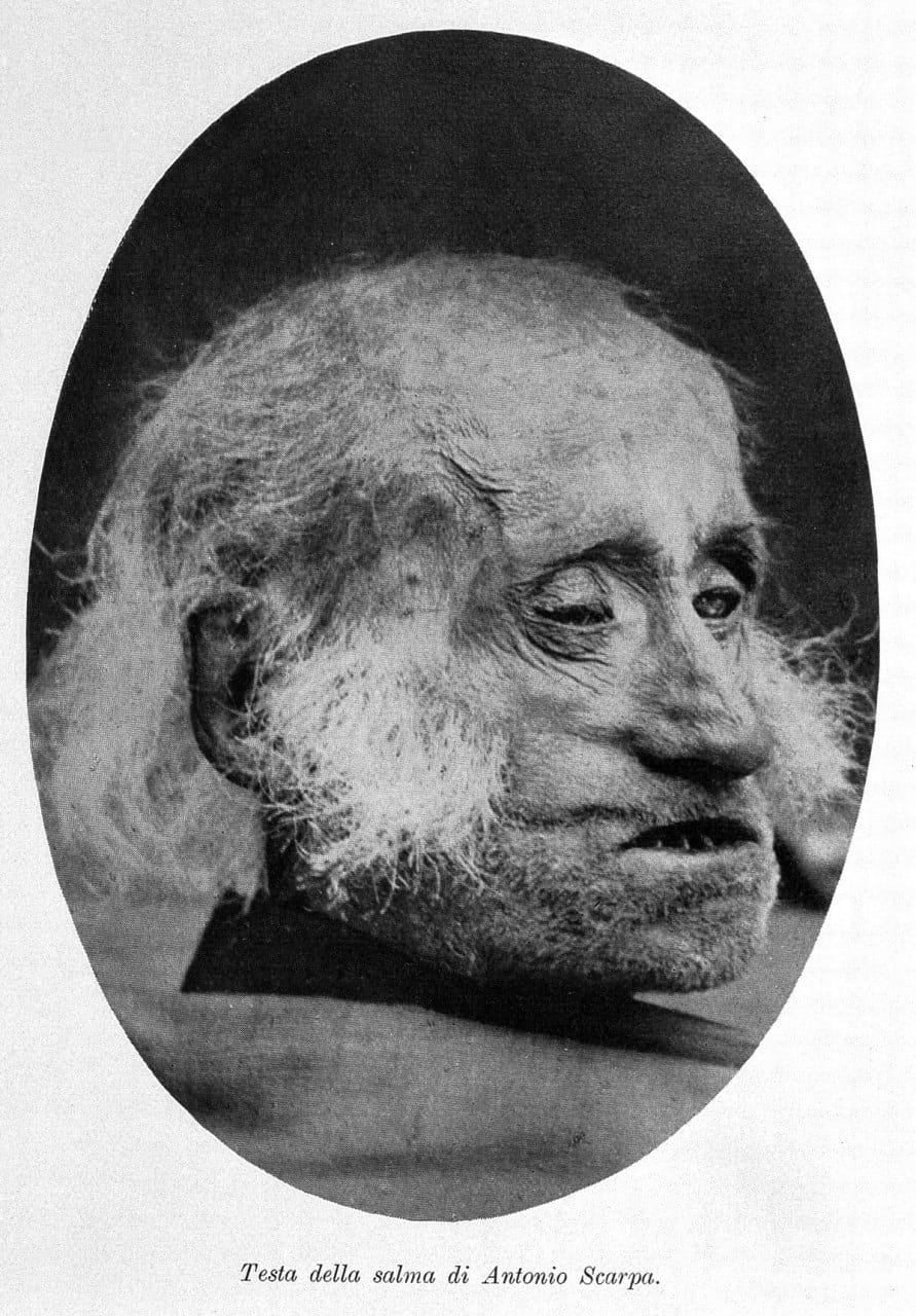 Голова именитого хирурга Антонио Скарпа (1752-1832), хранится в музее Университета Павии