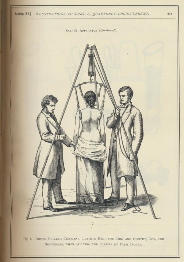 Аппарат Льюиса Сайра 1882 года для лечения туберкулезного спондилита