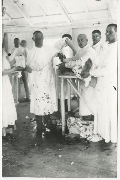 Ампутация ноги, Духовщинский полк, 1915-1917