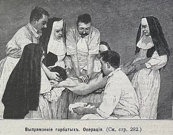 Я бы скорее щеголял горбом, чем решился на такую "операцию"